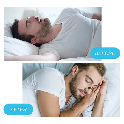 Anti-Snoring Nose Clip Kit with Magnetic Strips Nasal Breathing Dilators for Improved Sleep & Sports Performance Snore Prevention Combo